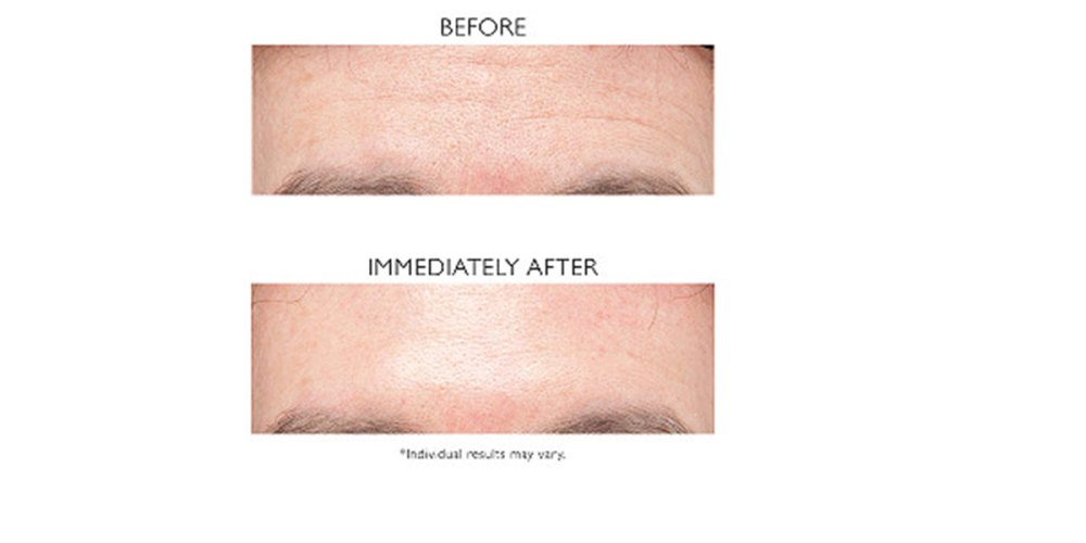 Peter Thomas Roth Instant FIRMx Eye