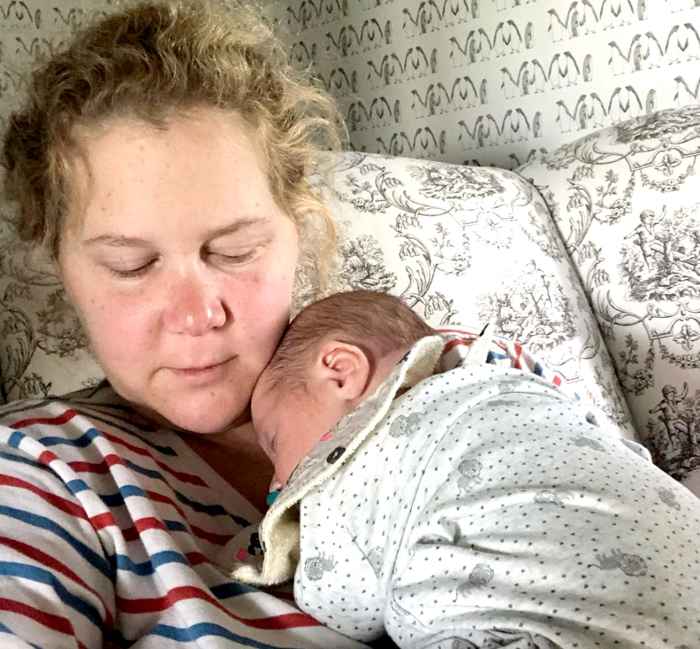 Amy Schumer’s ‘Really Scary’ C-Section Took 3 Hours