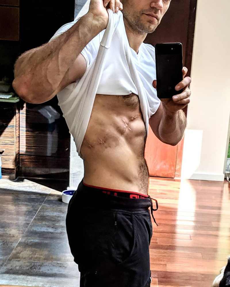 Henry Cavill Details Extreme Diet for 'The Witcher'