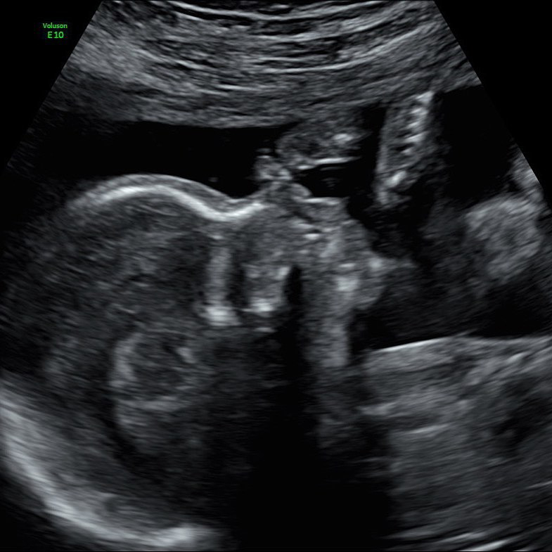 Pregnant Malika Haqq Reveals Ultrasound Photo of ‘Angel’ Baby
