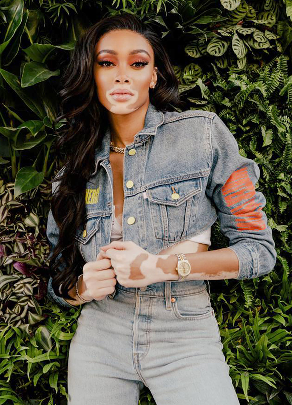 Winnie Harlow On Working With Kim Kardashian