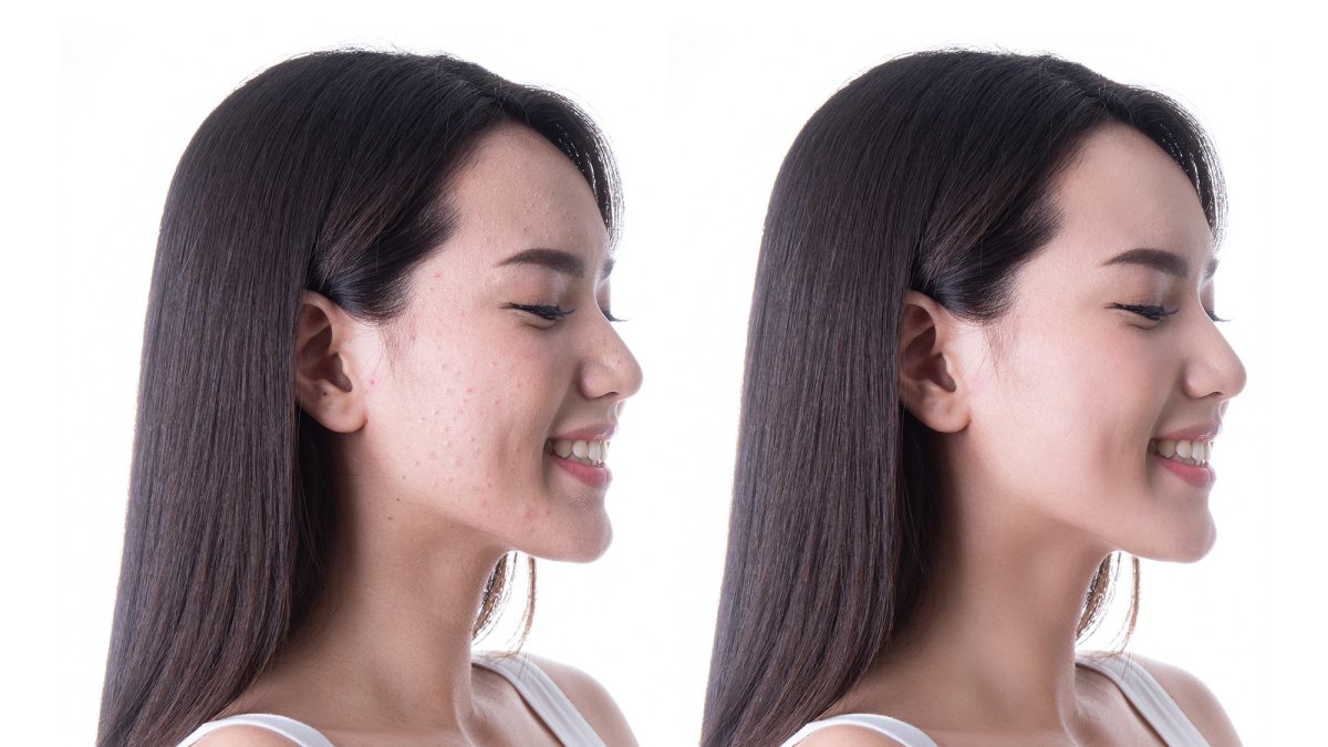 Before-and-After
