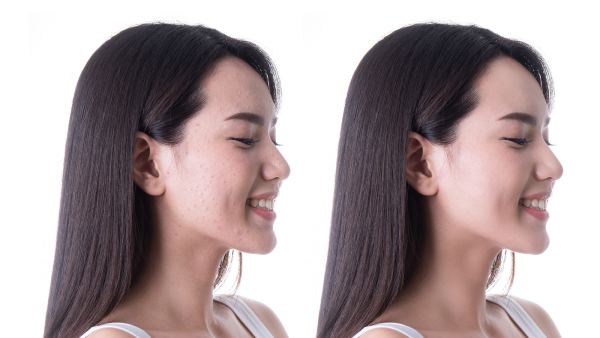 Before-and-After