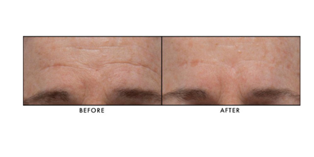 Lancer Skincare The Method: Normal-Combination Skin, 3-Piece Kit