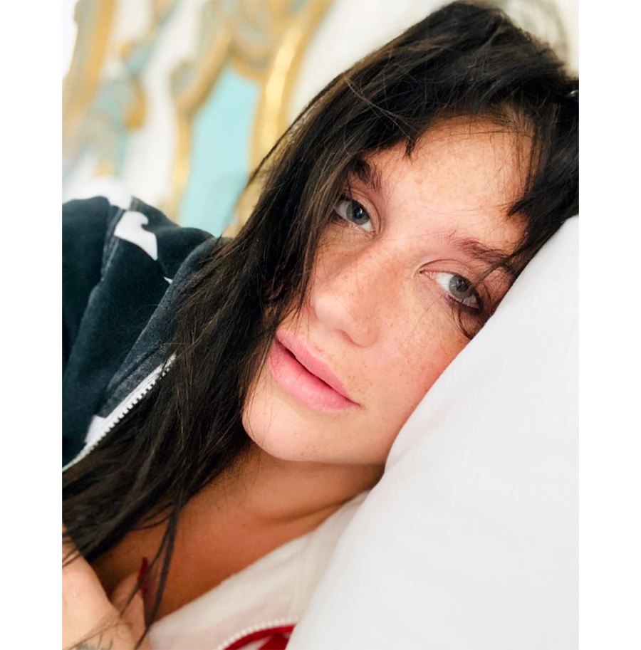 Kesha's Freckles Selfie