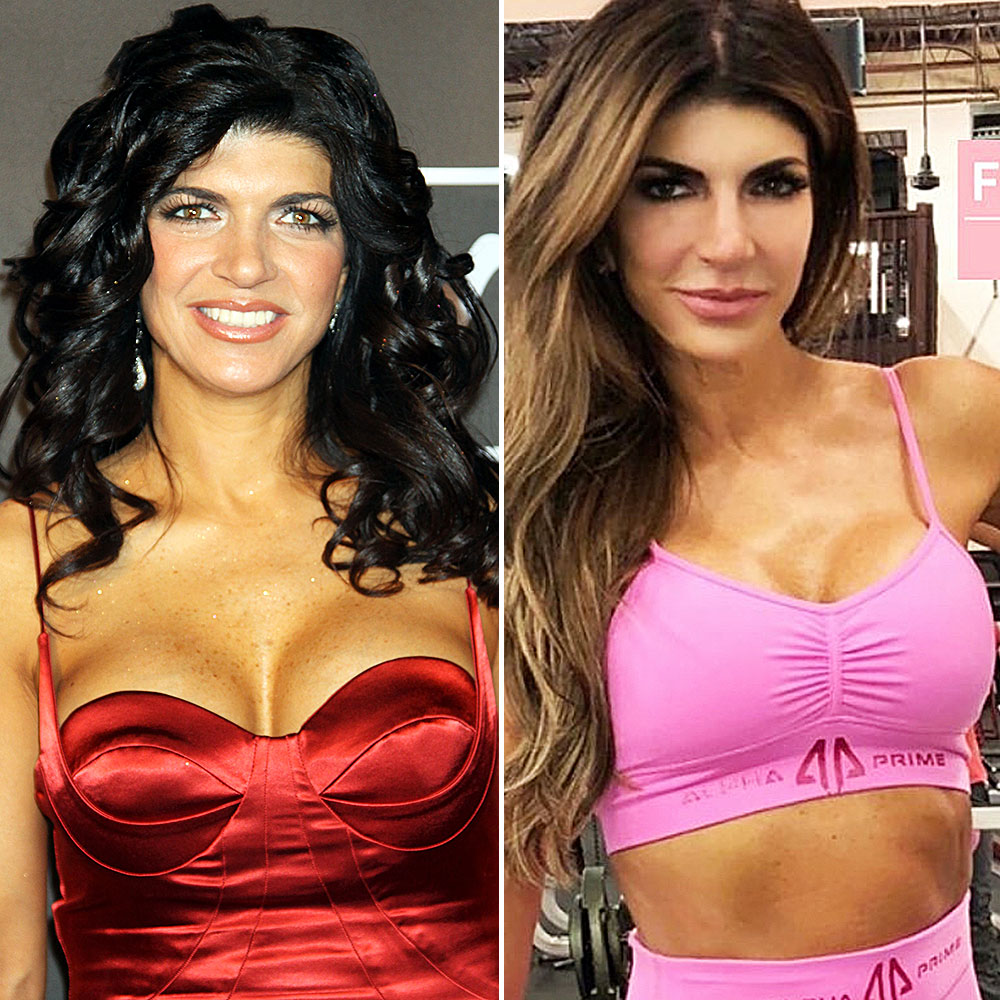 Teresa Giudice Explains Why She Had Her Breasts Redone Ten Years After First Augmentation