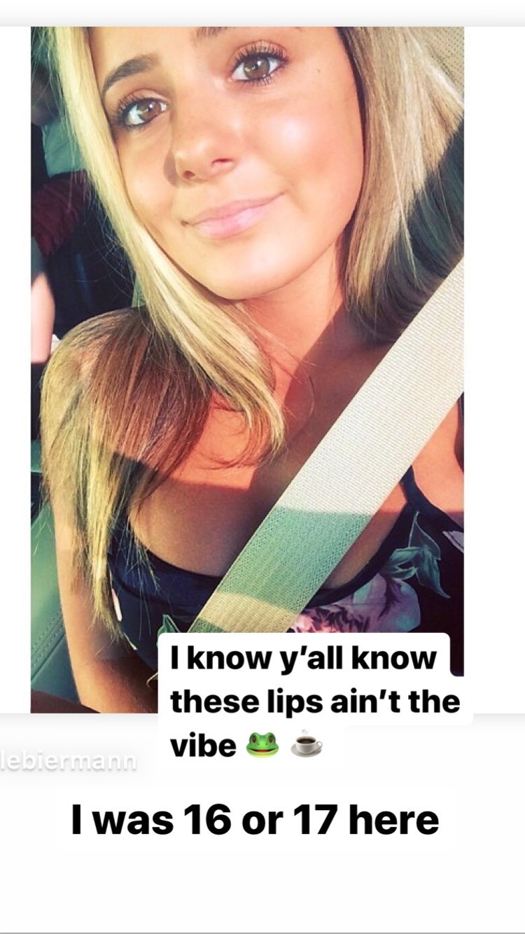 Brielle Biermann Says She Is Getting Her Lip Fillers Dissolved: Photo