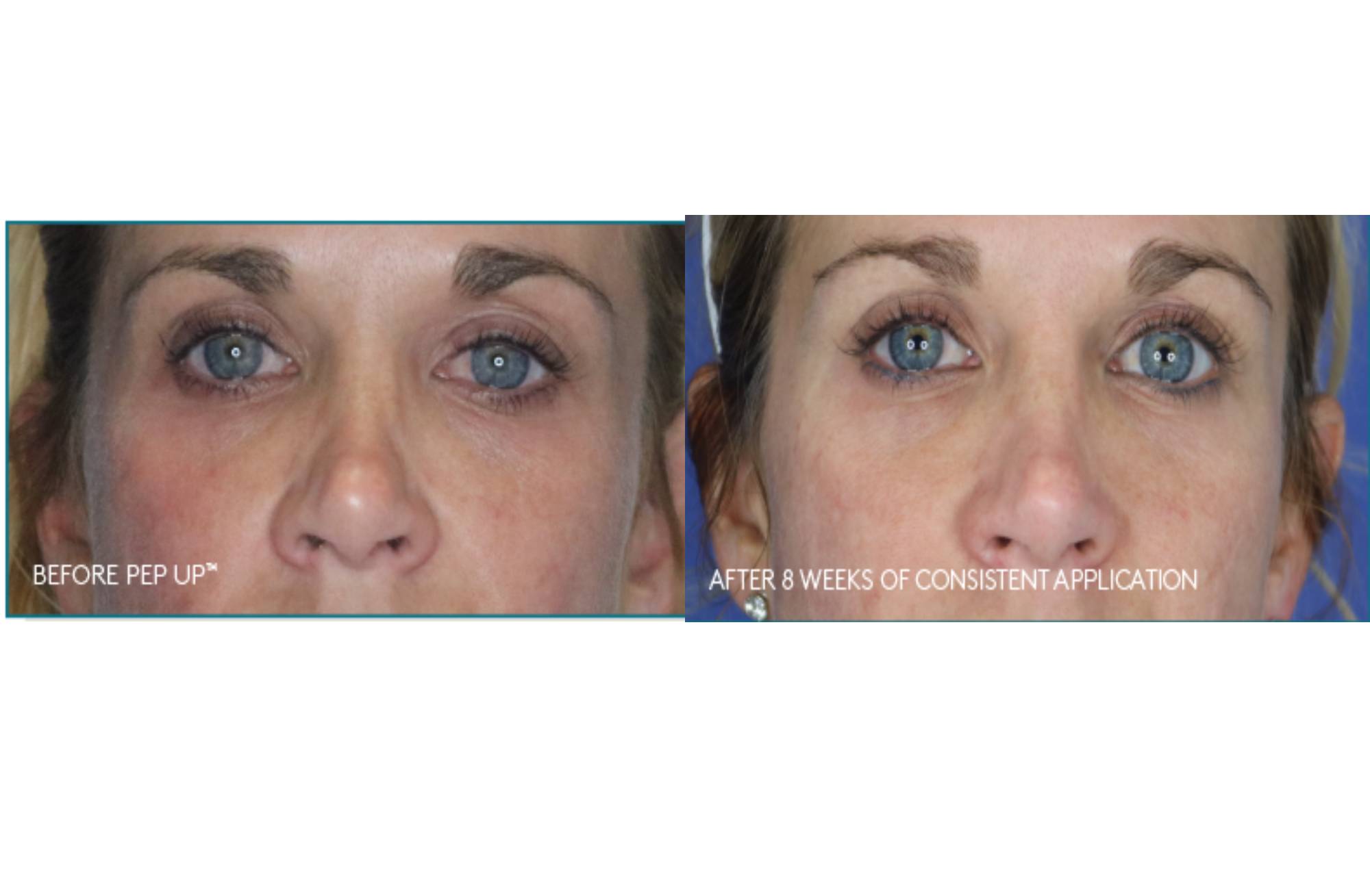 Colorescience Pep Up Collagen Renewal Face & Neck Treatment