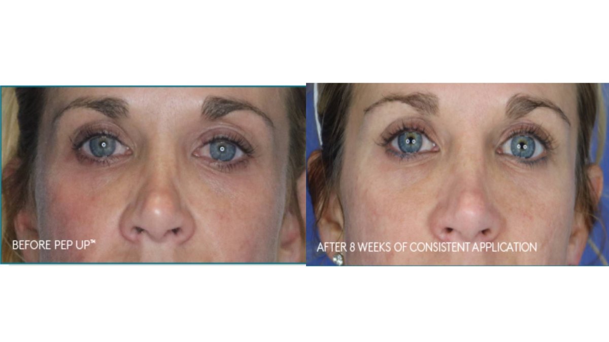 Colorescience Pep Up Collagen Renewal Face & Neck Treatment