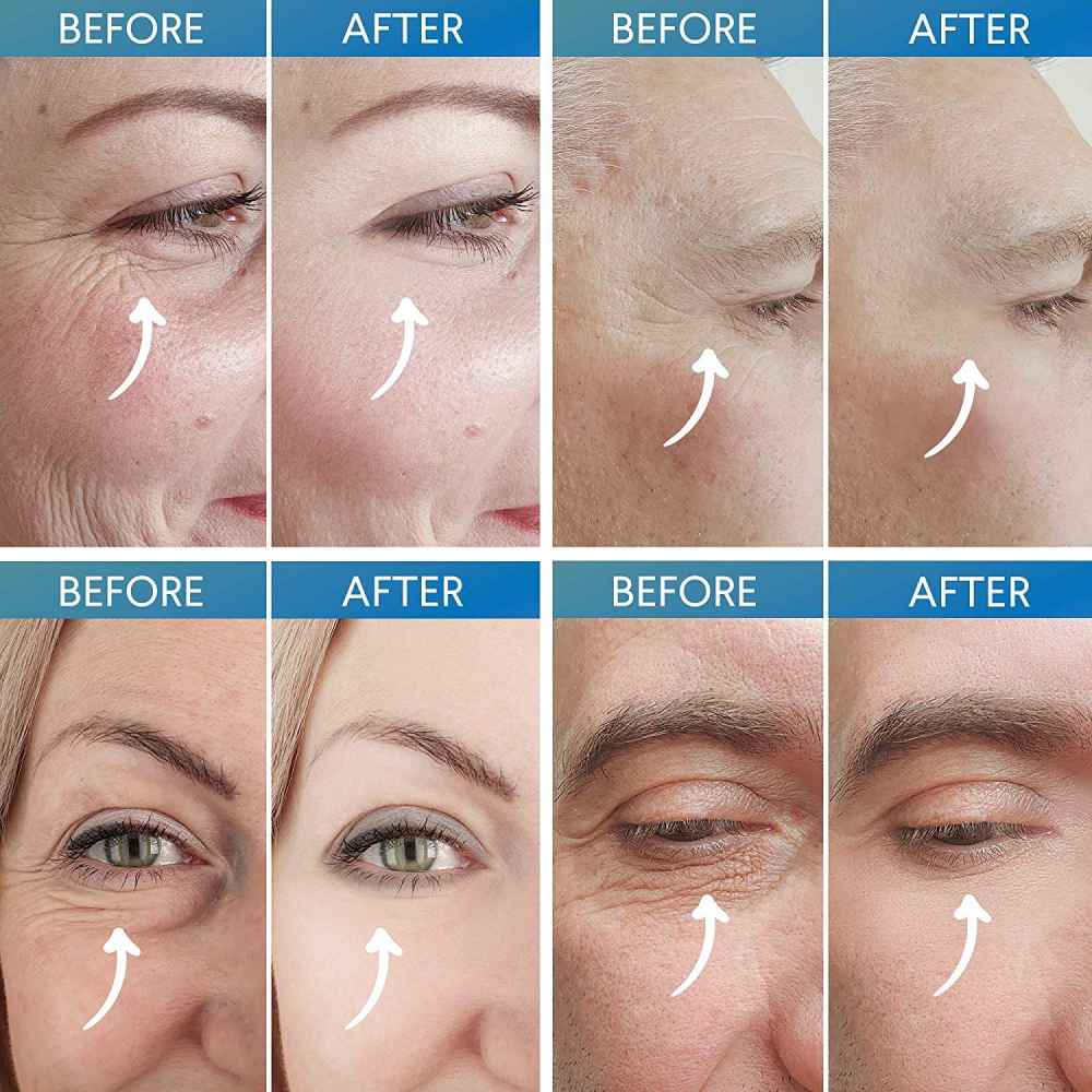 Evagloss Rapid Reduction Eye Cream