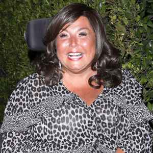 Abby Lee Miller Reveals Facelift Results See Before After Photos