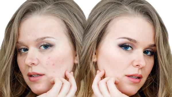 before-after-skin