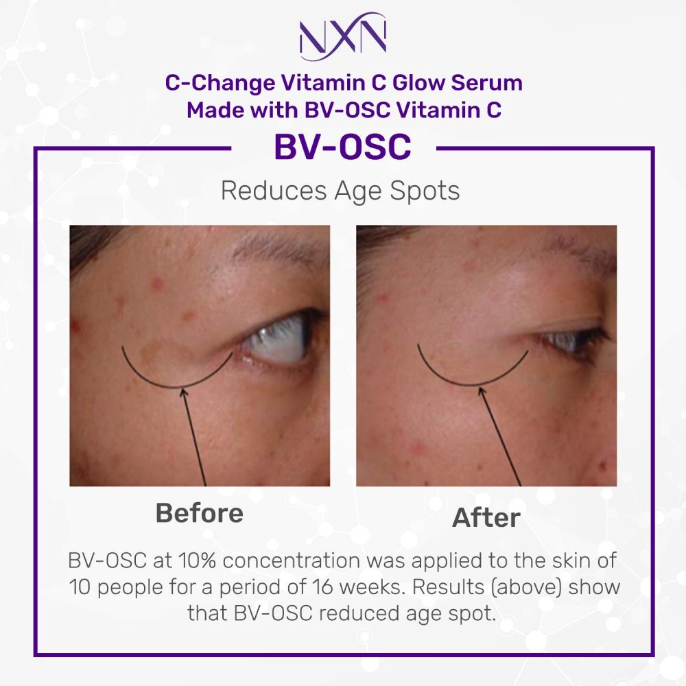 nXn-before-after