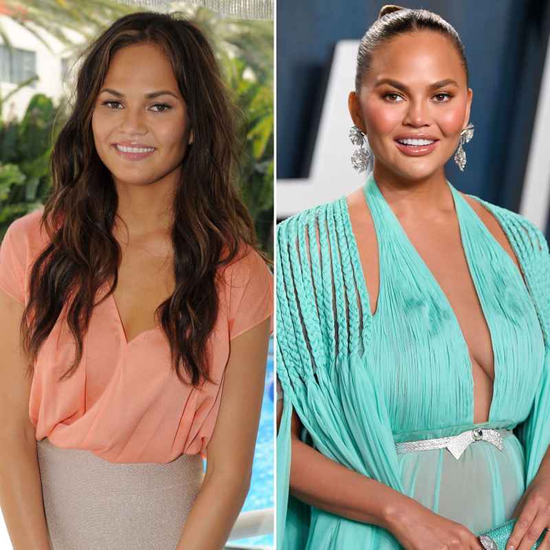 Chrissy Teigen Stars Who Admitted to Getting Plastic Surgery