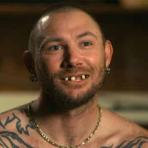 John Finlay before and after new teeth Tiger King 2