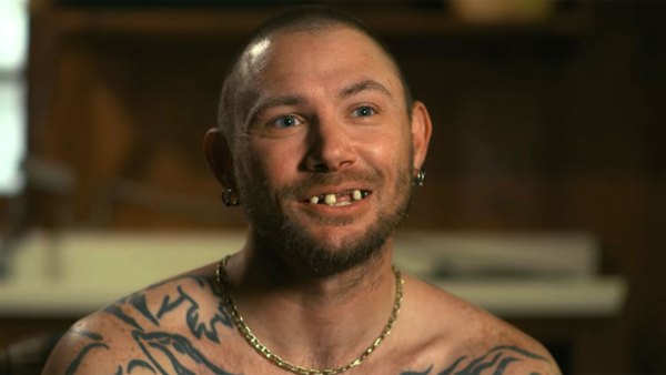 John Finlay before and after new teeth Tiger King 2