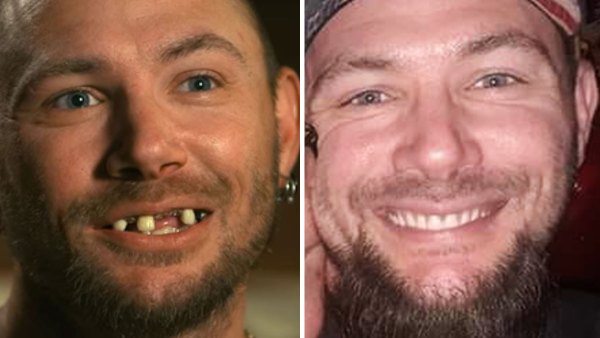 Tiger Kings Doc Antle Says John Finlays Teeth Were Fixed Before Taping