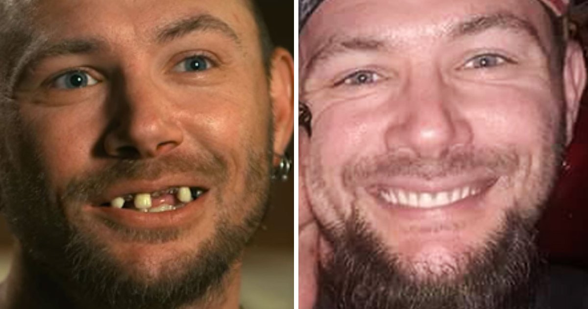 This Guy Fixed His Teeth by 3D-Printing His Own Plastic Braces For $60 :  ScienceAlert