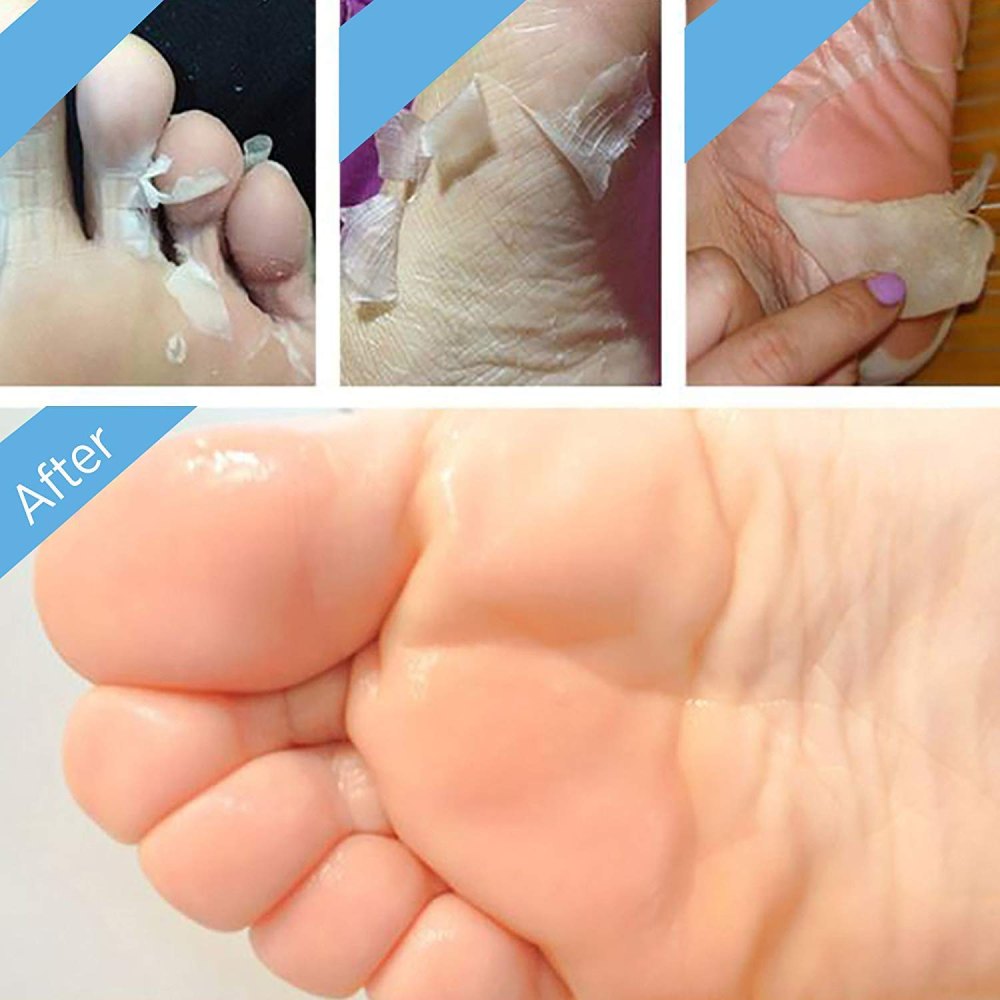 BEALUZ Exfoliating 2 Pair Foot Peel Mask