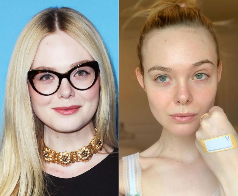 Elle Fanning Proves She Has the Best Skin in Hollywood