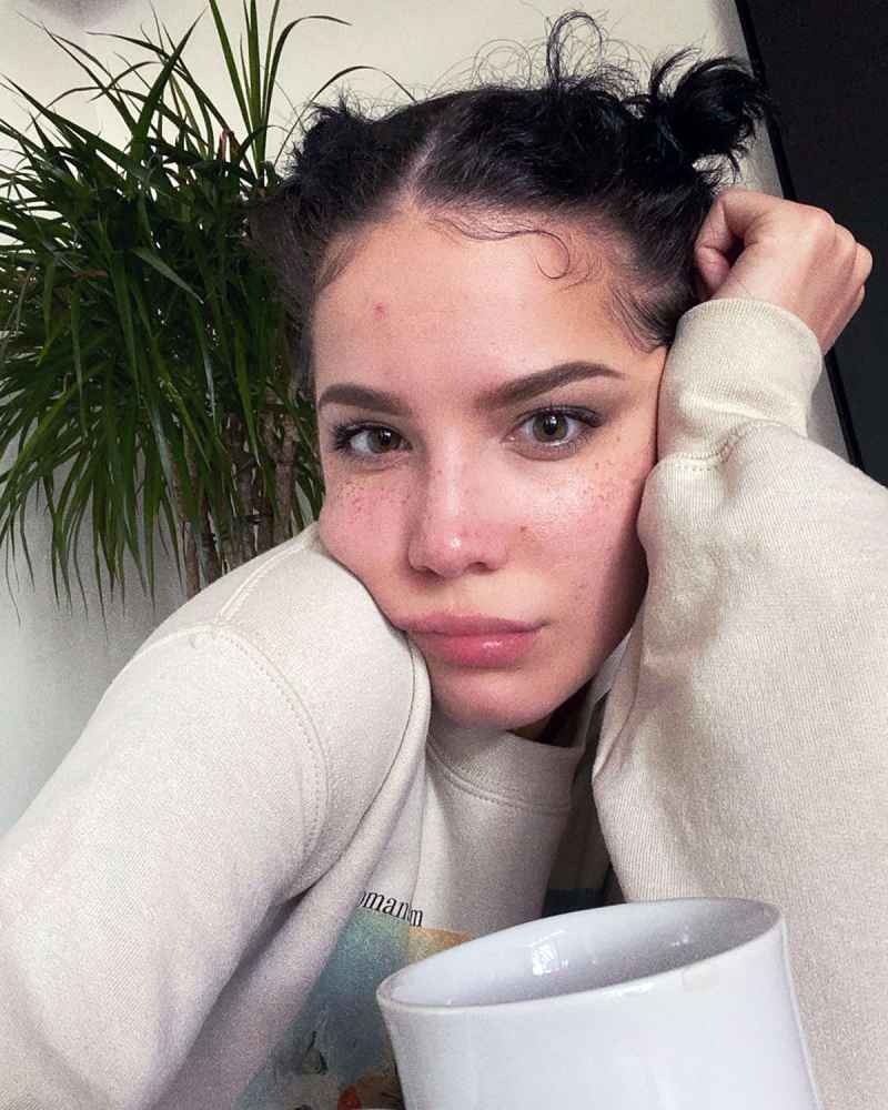 Halsey and More Stars Show Off Their Adorable Freckles: Pics