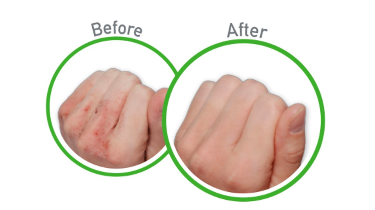 Hand-Before-And-After