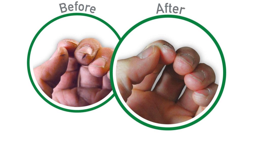 O'Keeffe's Working Hands Hand Cream