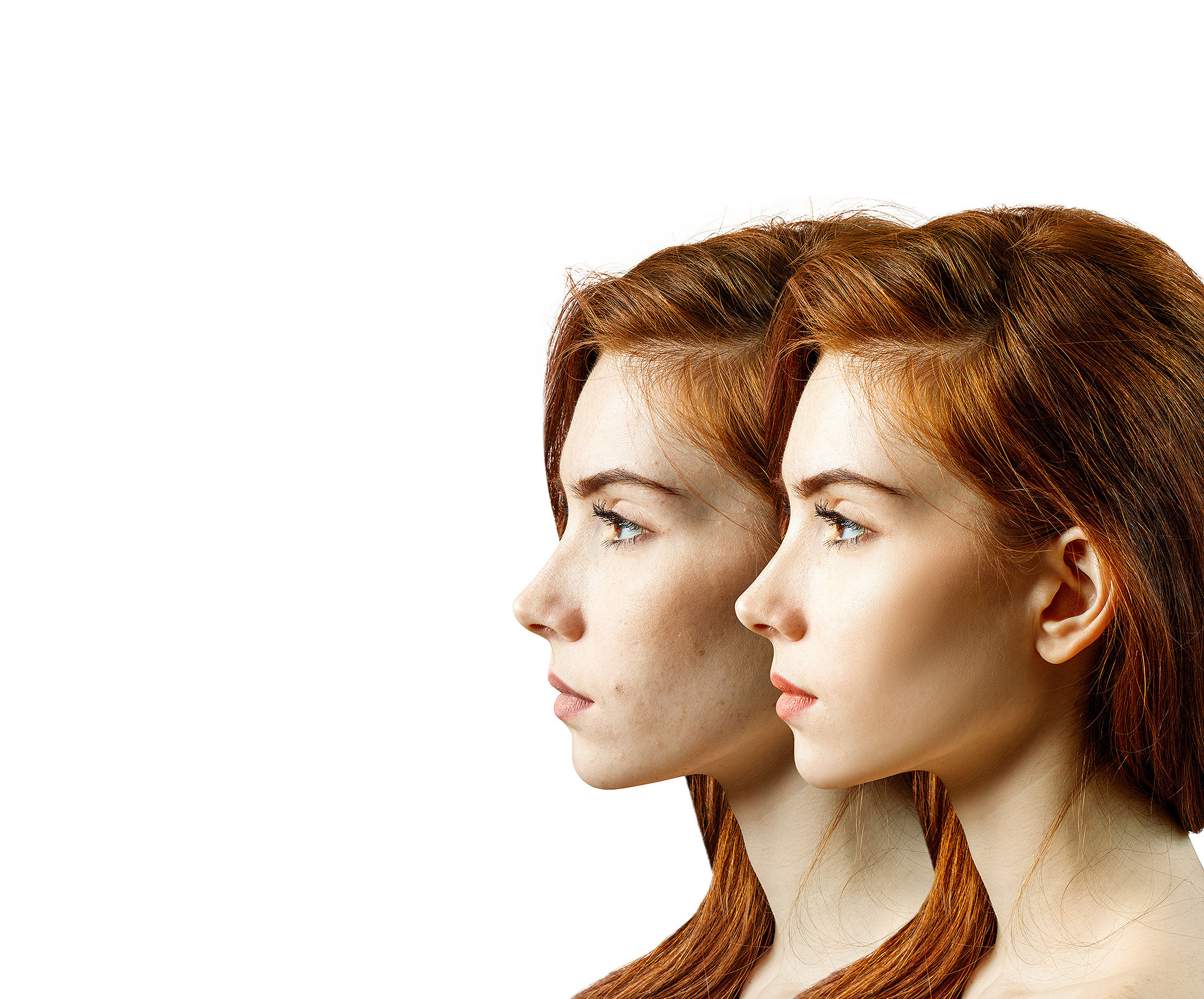 before-after-skin