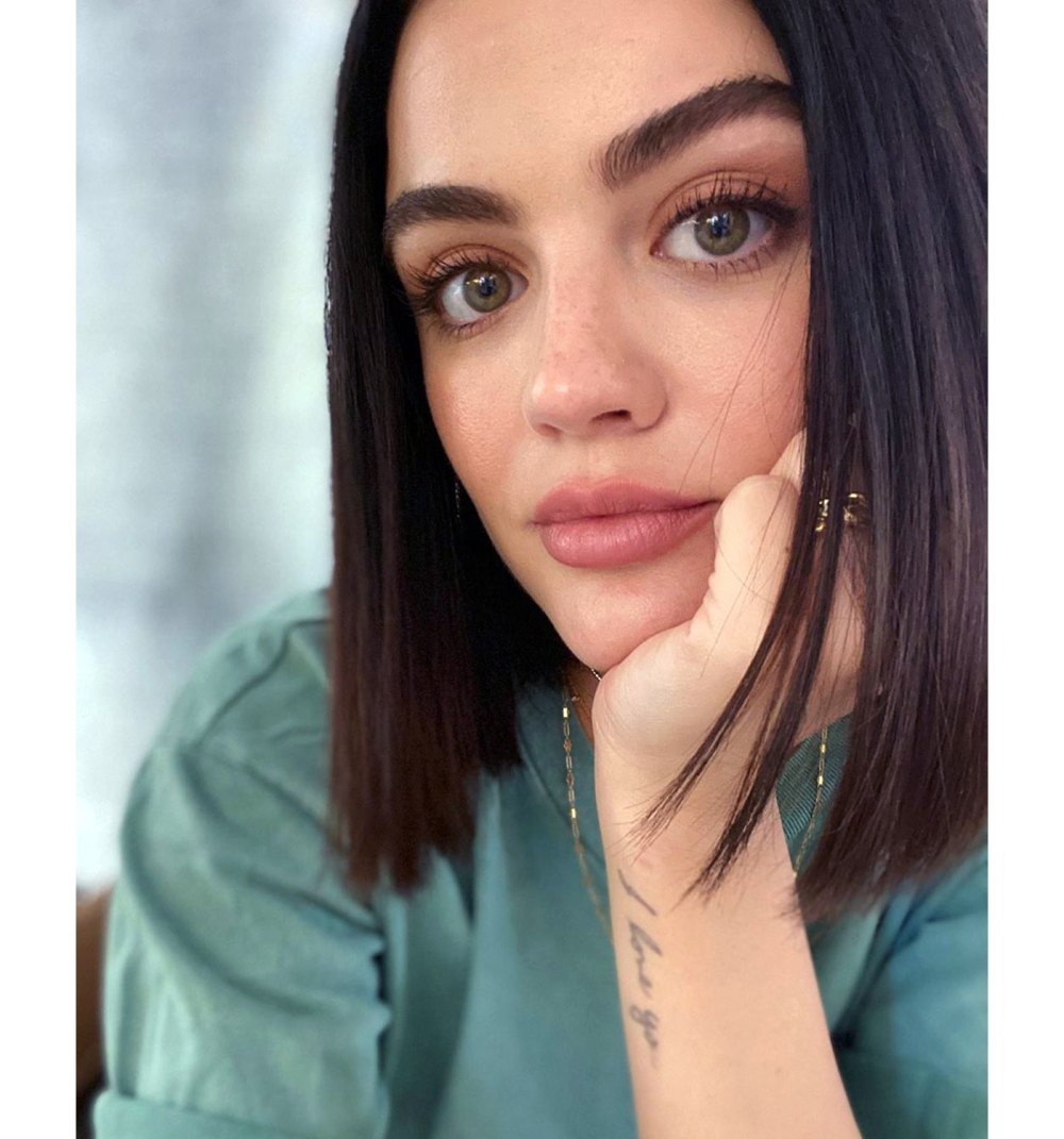 Celeb Freckles: Kylie Jenner, Demi Lovato and More