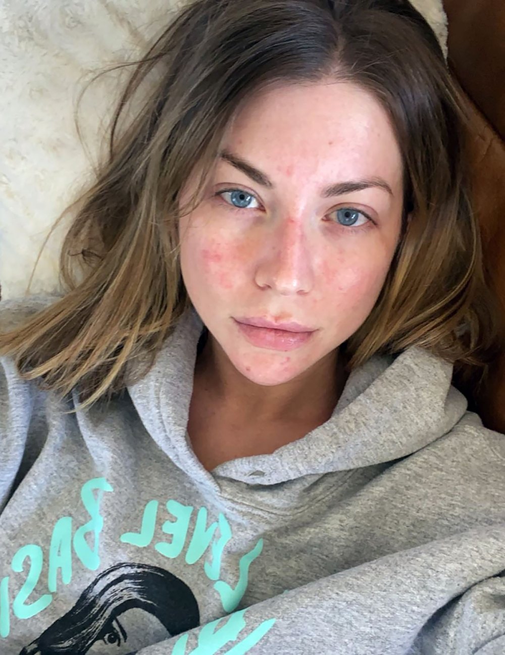 Stassi Schroeder Shows Psoriasis and Roots in Rare Makeup-Free Selfie