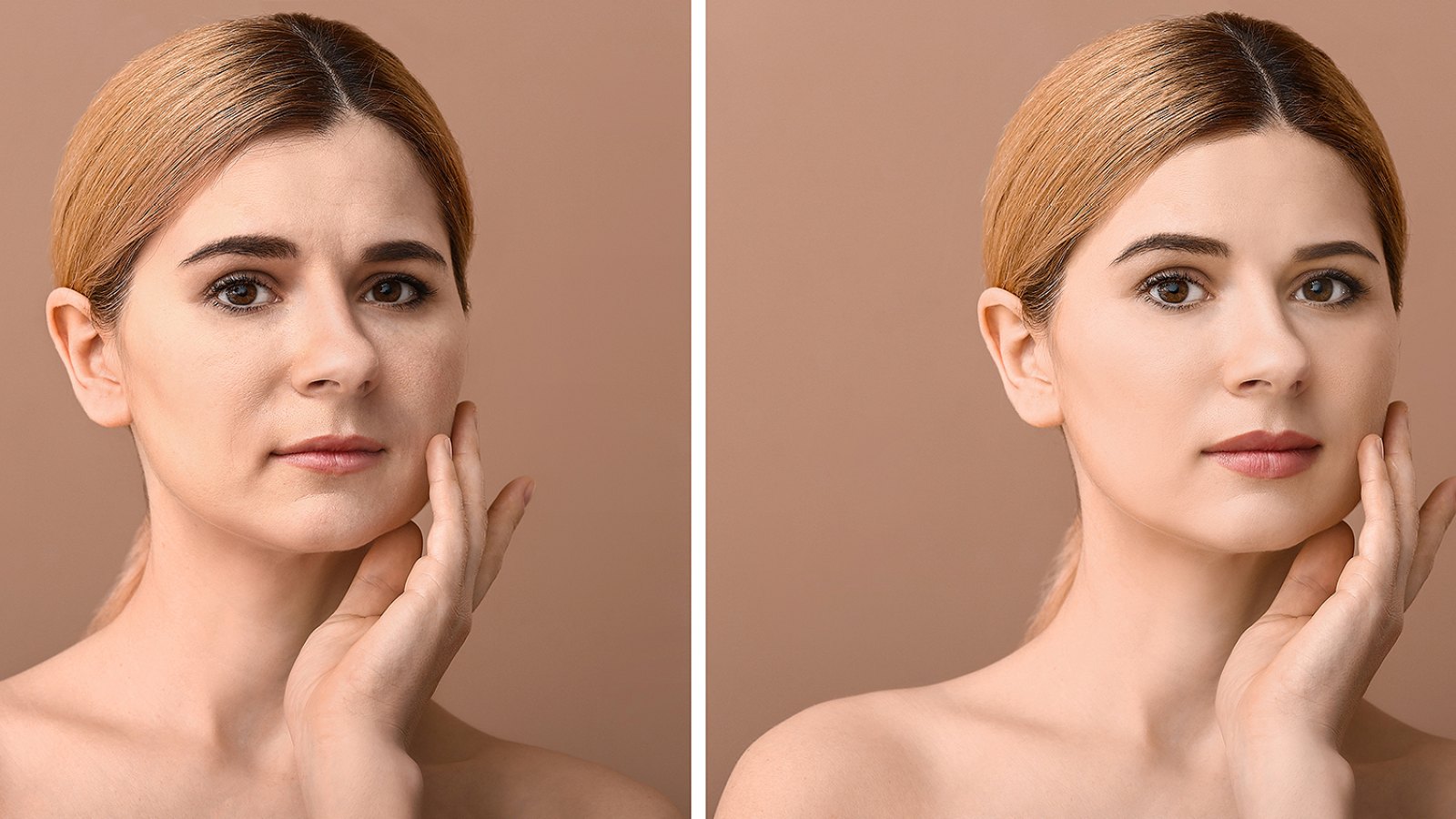 before-after-skin
