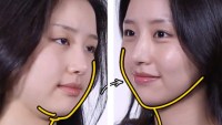 jawline-contour