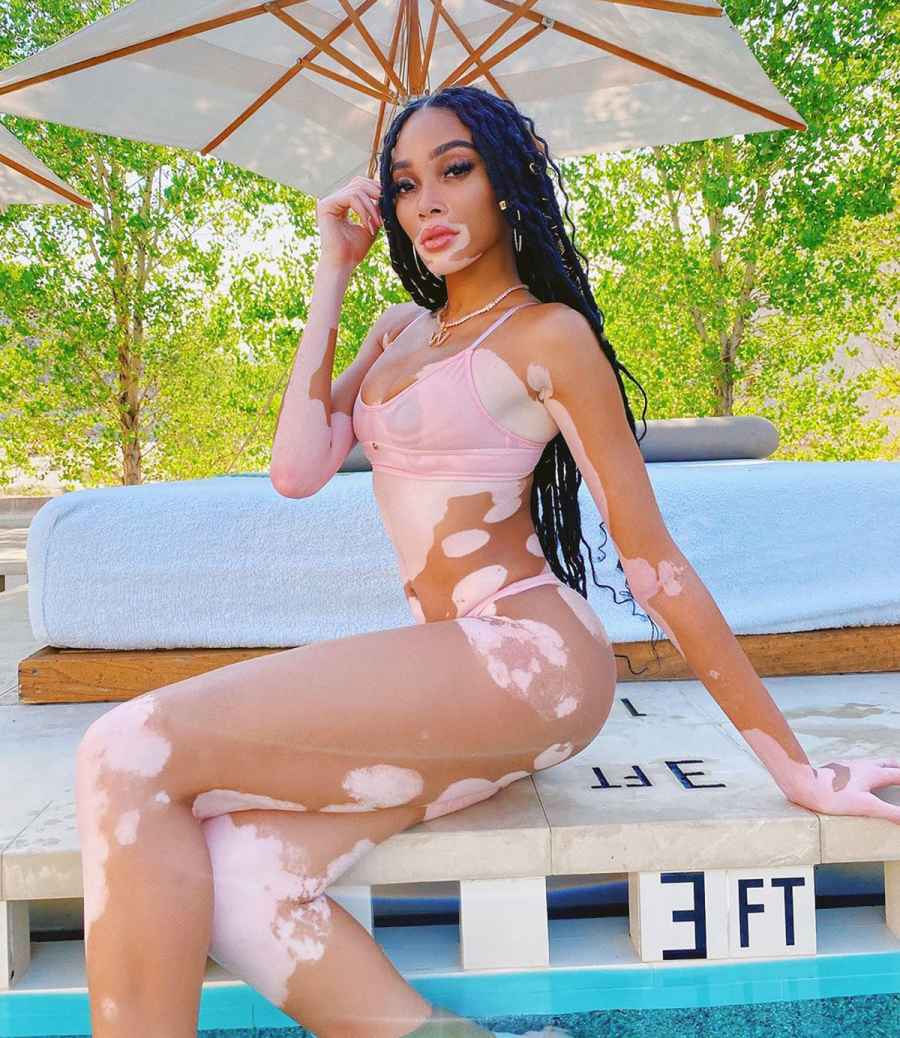 Winnie Harlow Sends Temperatures Rising in a Sheer Bikini