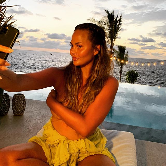Chrissy Teigen Shares Pic of Breast Implant Removal Surgery and Scars