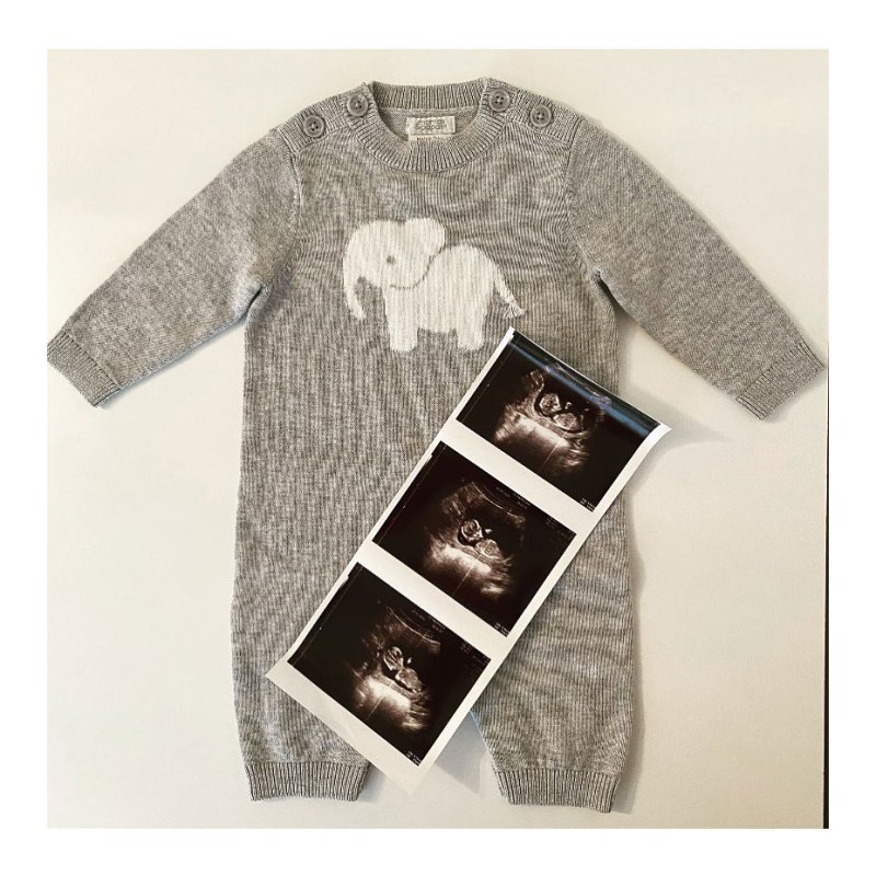 Devon Murray Harry Potter Expecting 1st Child With Girlfriend Shannon McCaffrey Quinn