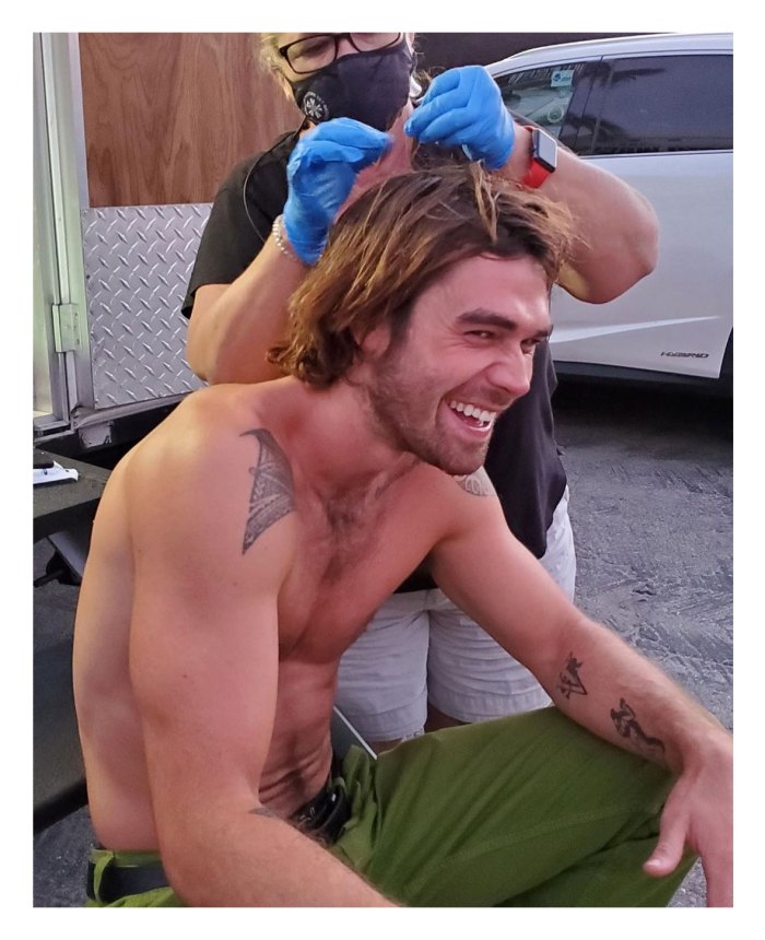 Gallery KJ Apa Gets Stitches in His Head After Suffering Injury on Set