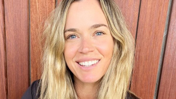 Teddi Mellencamp Says Daughter Dove May Need to Wear Helmet for a Year After Surgery 2