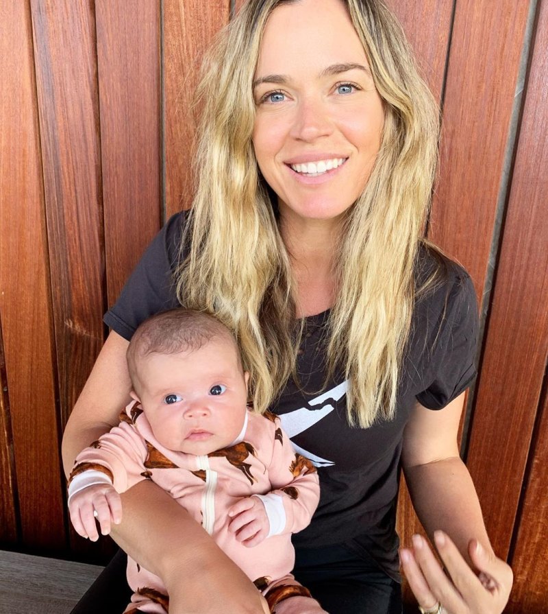 Teddi Mellencamp Says Daughter Dove May Need to Wear Helmet for a Year After Surgery 2