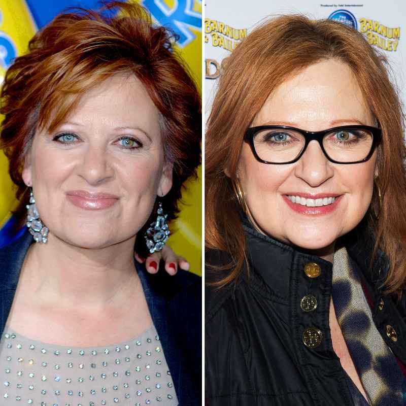 Caroline Manzo before and after plastic surgery