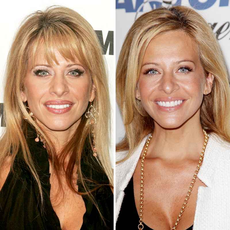 Dina Manzo before and after plastic surgery