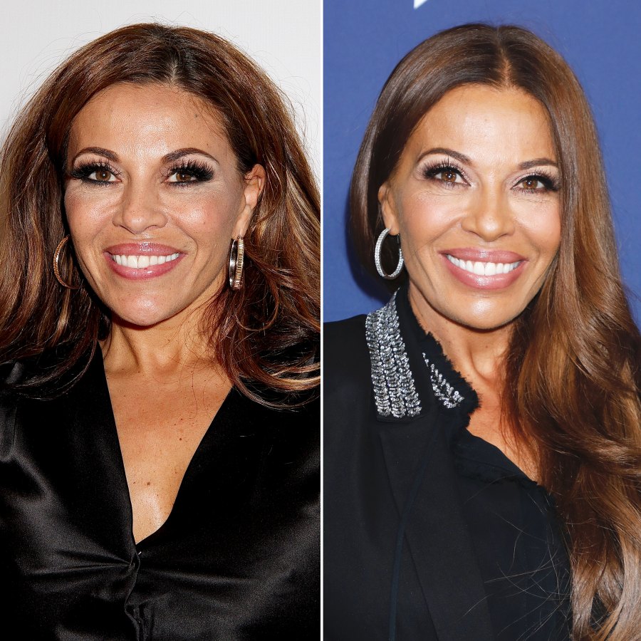 Real Housewives Plastic Surgery Before And After Phot vrogue.co