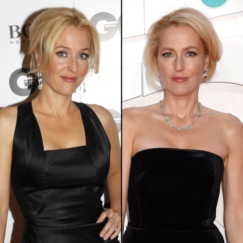 Gillian Anderson Hannibal Where Are They Now