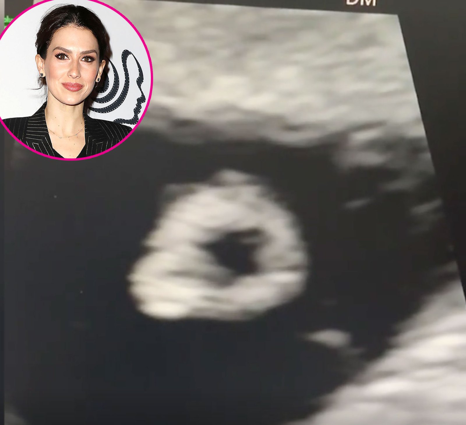 Hilaria Baldwin Pregnant Stars Share Ultrasound Pics