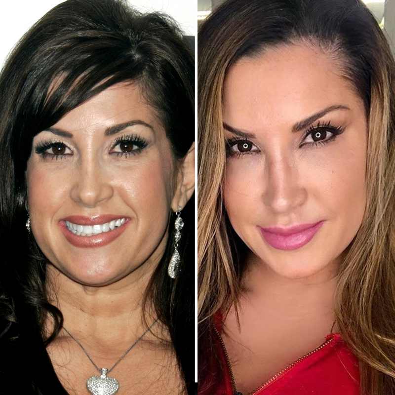 Jacqueline Laurita before and after plastic surgery 1
