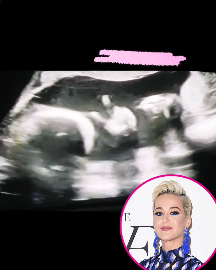 Katy Perry Pregnant Stars Share Ultrasound Pics