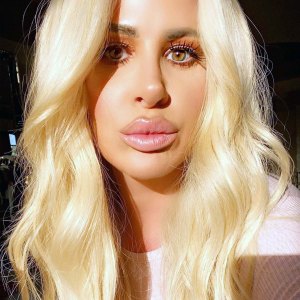 The Evolution of Kim Zolciak’s Beloved Lip Fillers: Pics