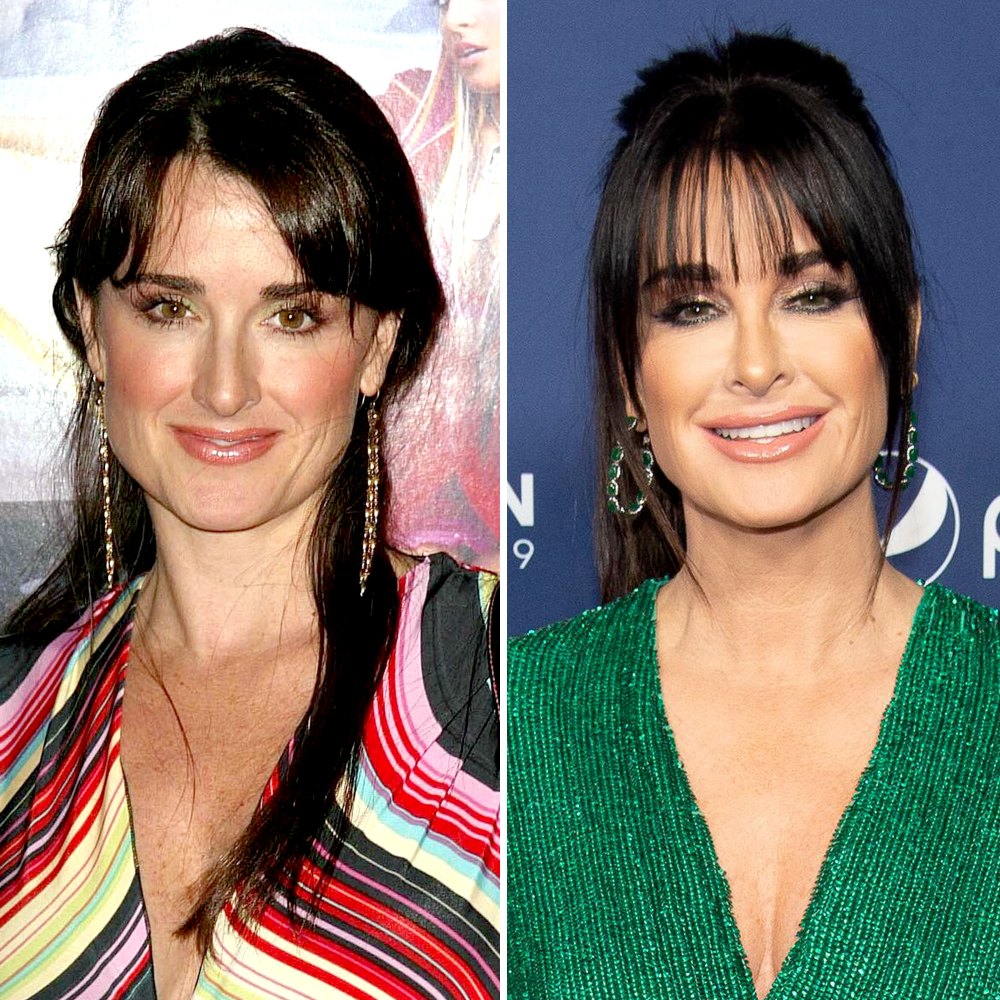 Real Housewives' Plastic Surgery Before and After Photos
