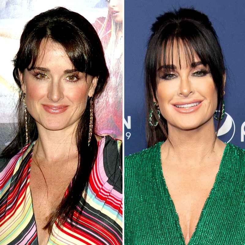 Kyle Richards before and after plastic surgery