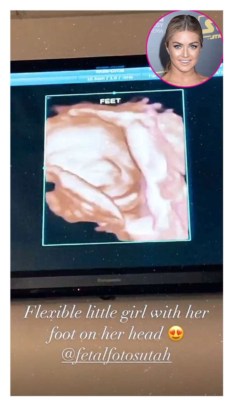 Lindsay Arnold Pregnant Stars Share Ultrasound Pics
