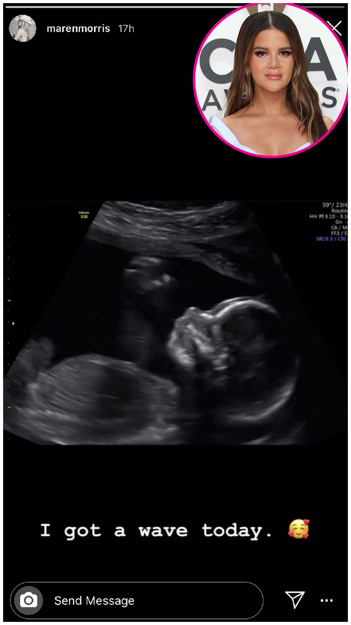 Maren Morris Pregnant Stars Share Ultrasound Pics